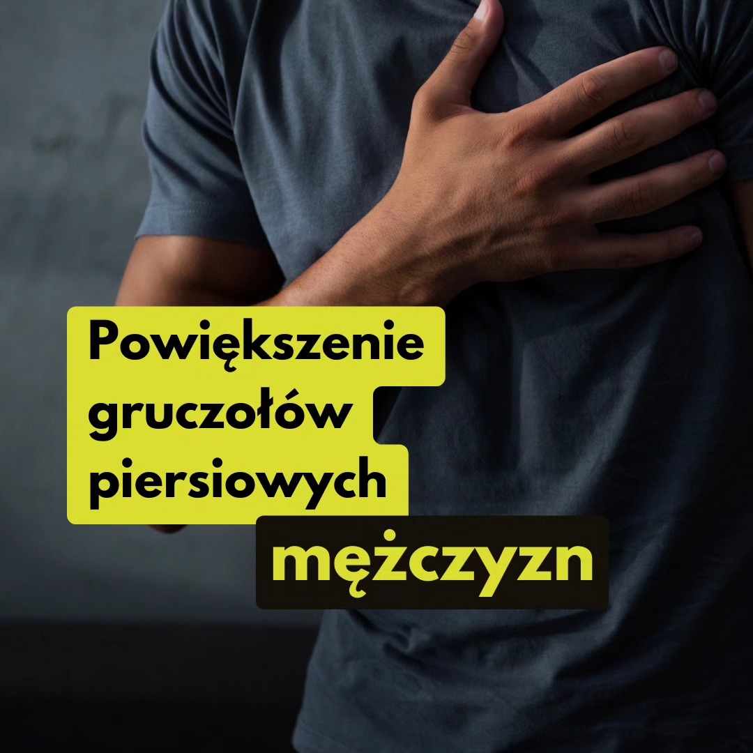 Post z 10.03.2024
